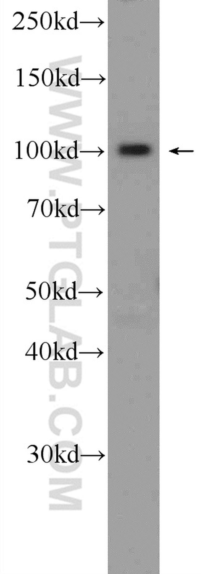 NFKB2 p52/p100 Antibody in Western Blot (WB)