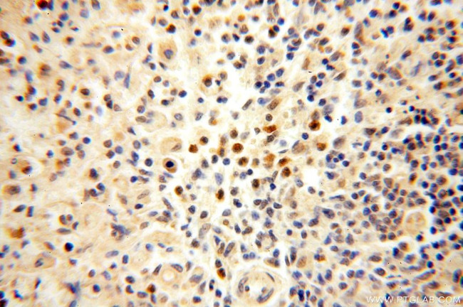 NFKB2 p52/p100 Antibody in Immunohistochemistry (Paraffin) (IHC (P))