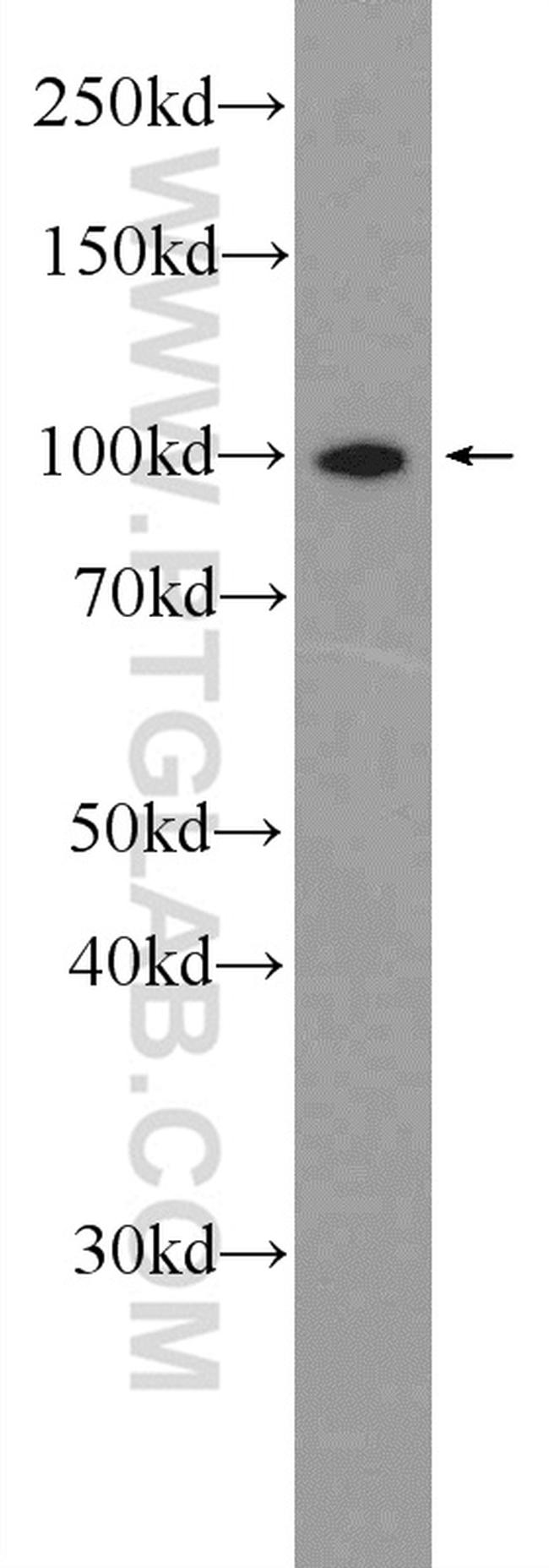 NFKB2 p52/p100 Antibody in Western Blot (WB)