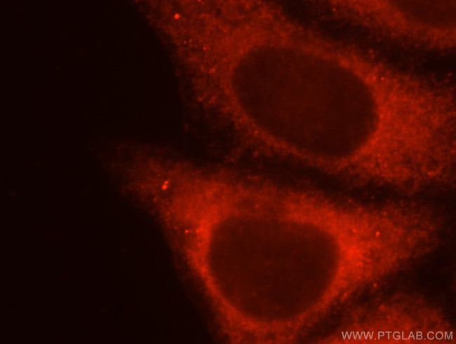 KISS1R Antibody in Immunocytochemistry (ICC/IF)