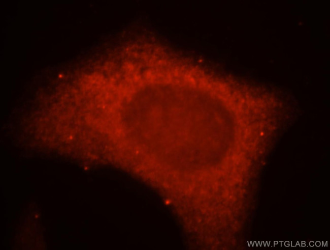 KISS1R Antibody in Immunocytochemistry (ICC/IF)