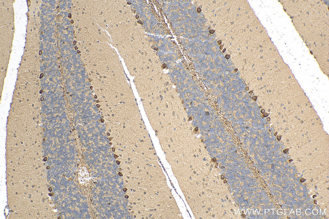 KISS1R Antibody in Immunohistochemistry (Paraffin) (IHC (P))