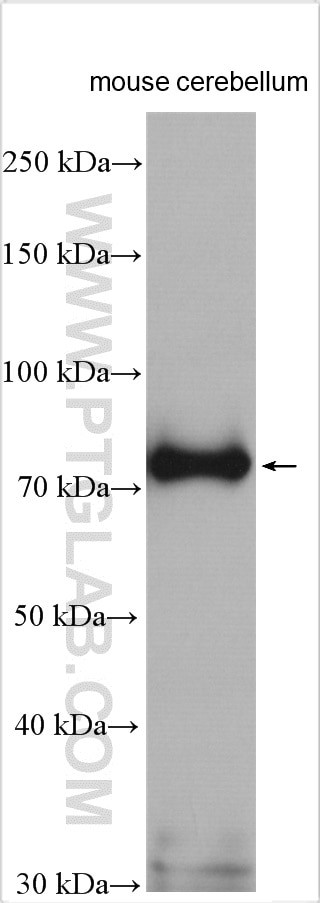 KISS1R Antibody in Western Blot (WB)