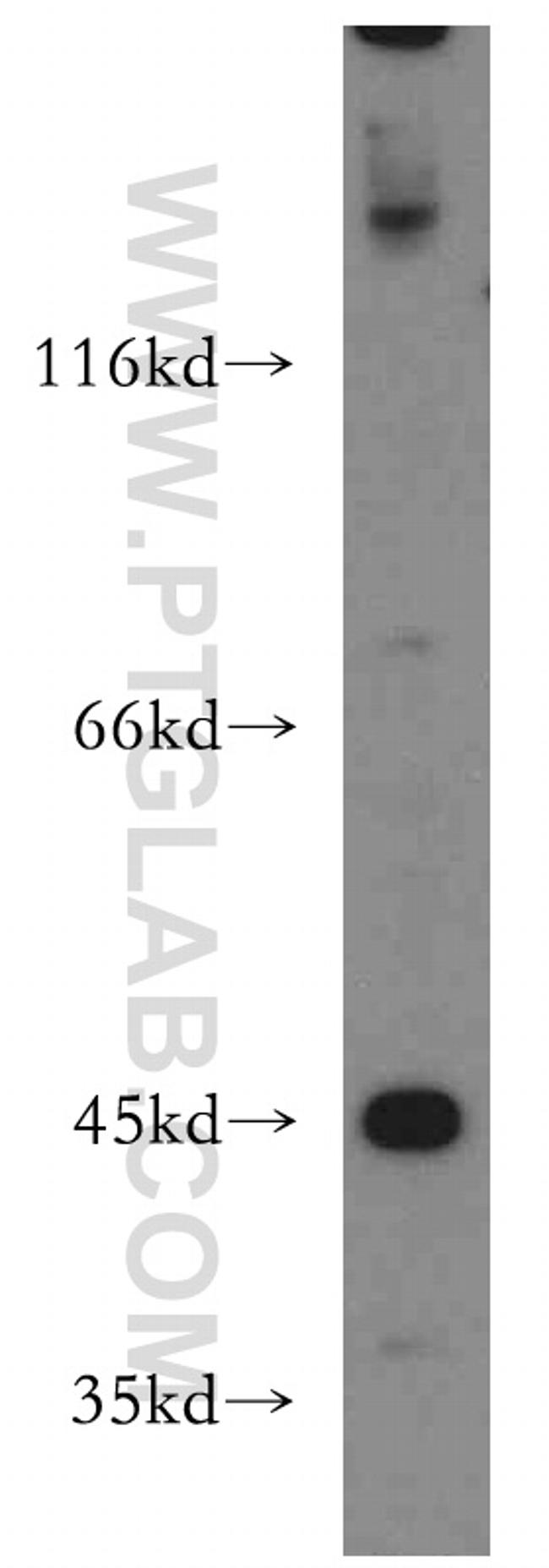 KISS1R Antibody in Western Blot (WB)