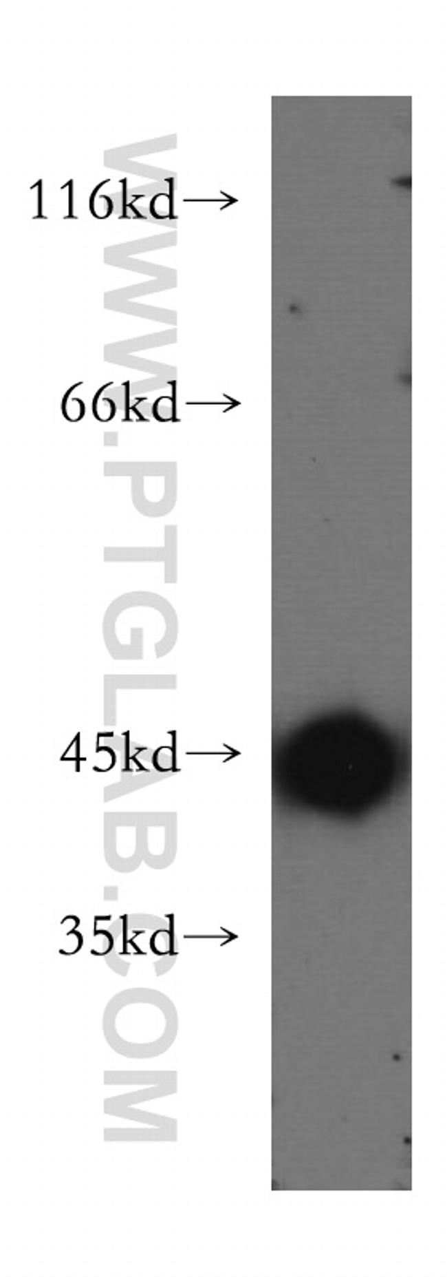 KISS1R Antibody in Western Blot (WB)