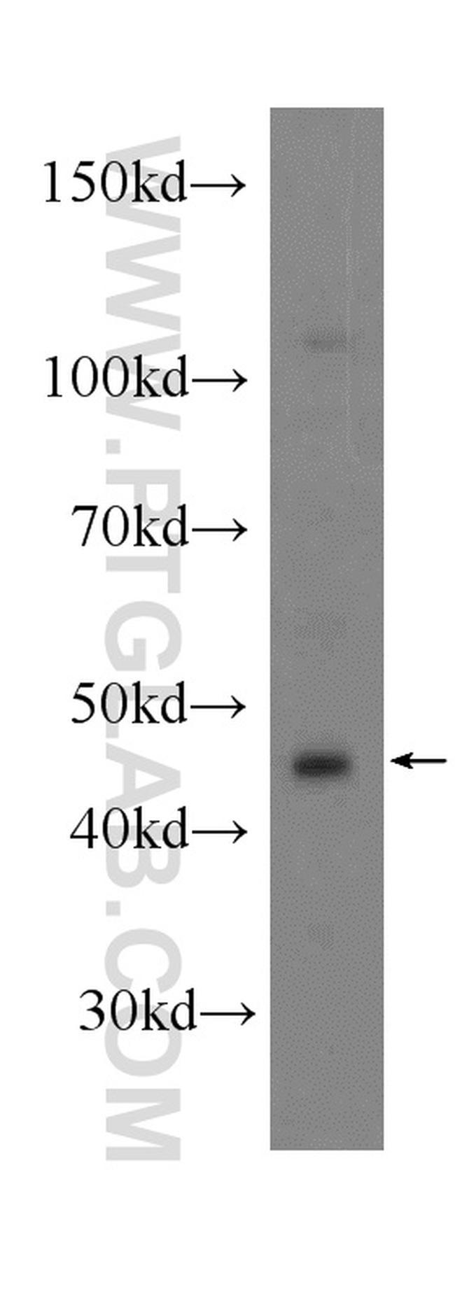 NFKB1 p105/p50 Antibody in Western Blot (WB)