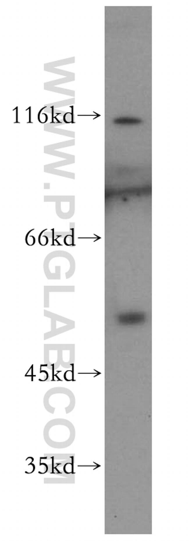 NFKB1 p105/p50 Antibody in Western Blot (WB)