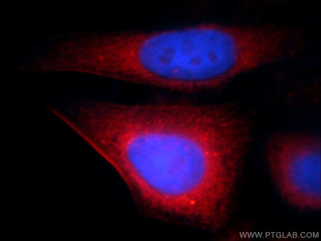 Transgelin-2 Antibody in Immunocytochemistry (ICC/IF)