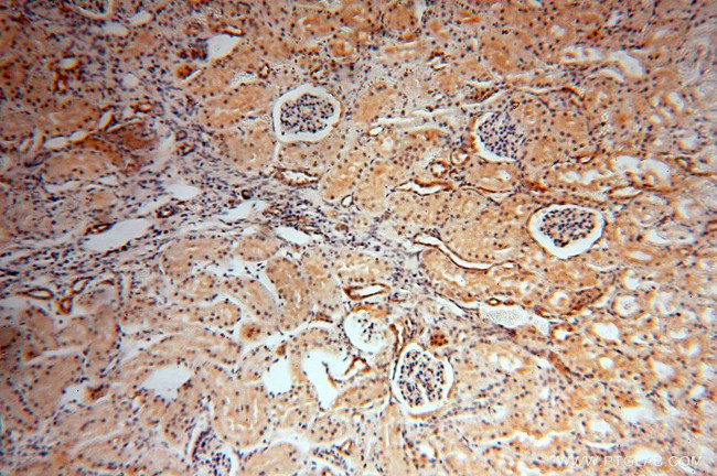 Transgelin-2 Antibody in Immunohistochemistry (Paraffin) (IHC (P))