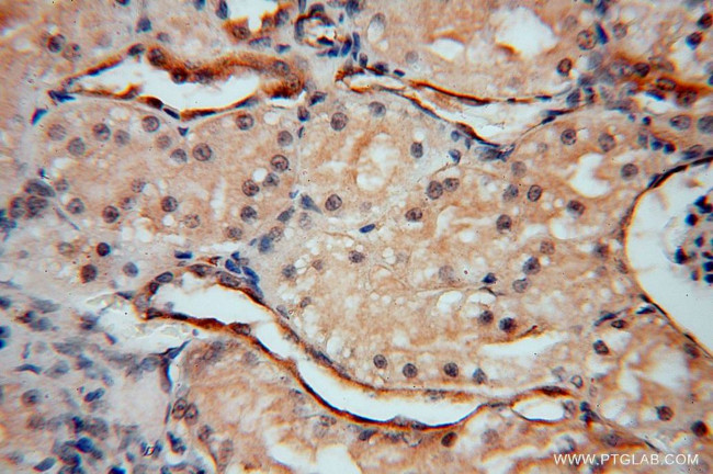 Transgelin-2 Antibody in Immunohistochemistry (Paraffin) (IHC (P))