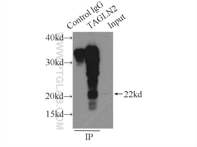 Transgelin-2 Antibody in Immunoprecipitation (IP)