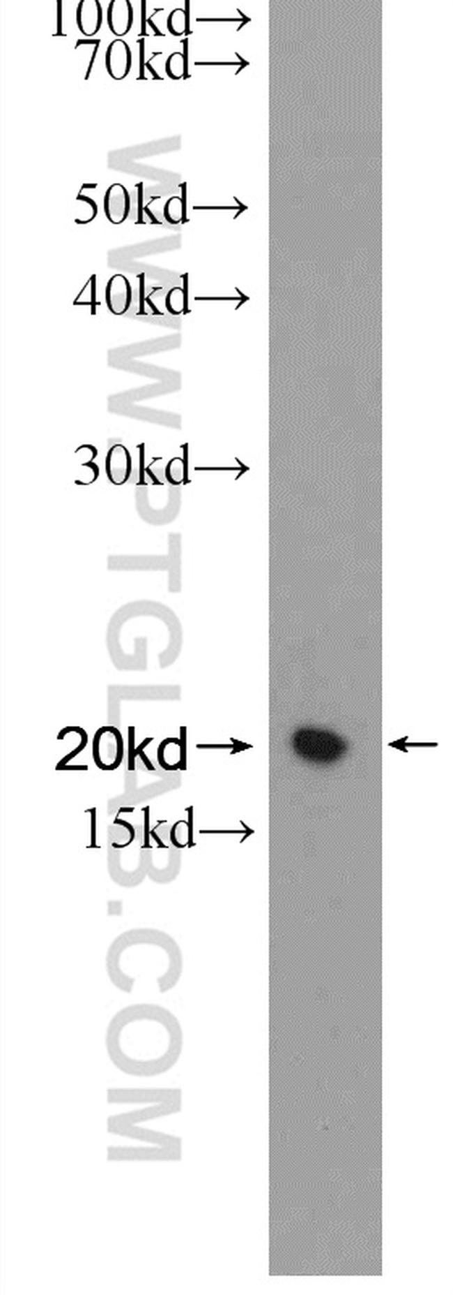 Transgelin-2 Antibody in Western Blot (WB)