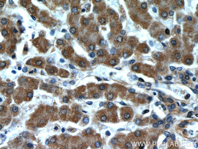 Transgelin-2 Antibody in Immunohistochemistry (Paraffin) (IHC (P))