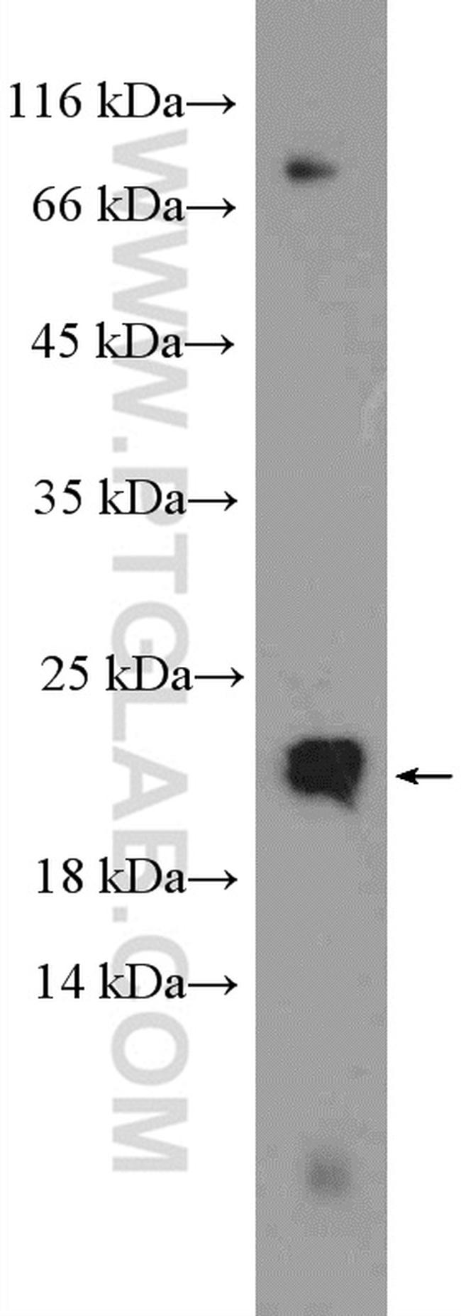 Transgelin-2 Antibody in Western Blot (WB)