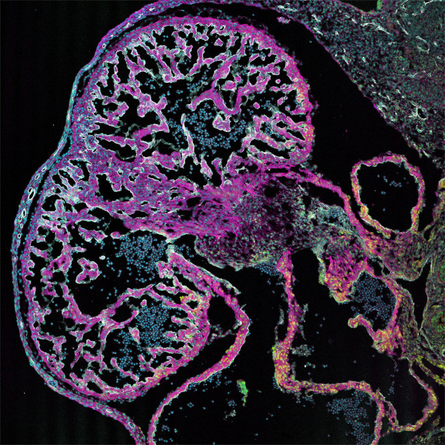 Cardiac Troponin T Antibody in Immunocytochemistry (ICC/IF)