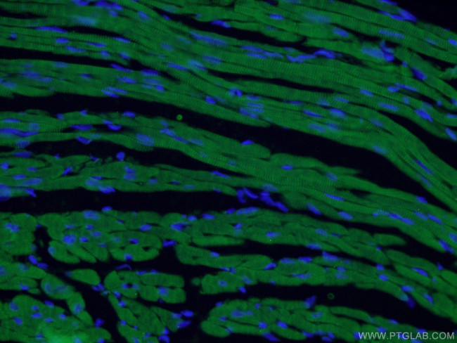 Cardiac Troponin T Antibody in Immunohistochemistry (PFA fixed) (IHC (PFA))