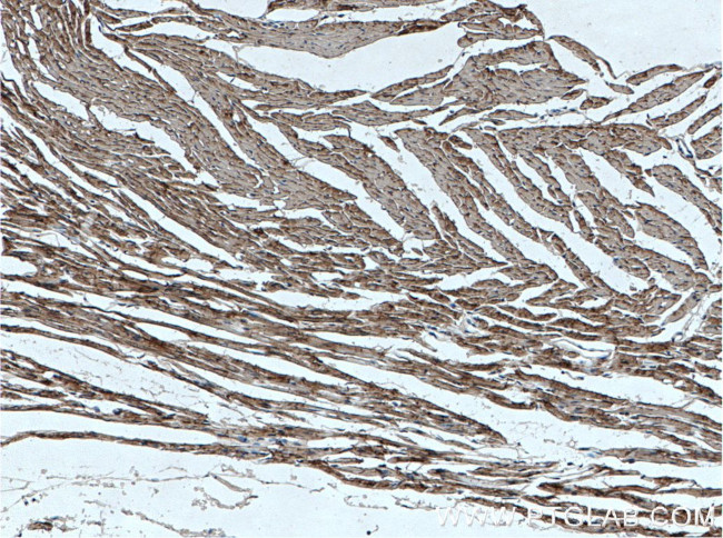 Cardiac Troponin T Antibody in Immunohistochemistry (Paraffin) (IHC (P))