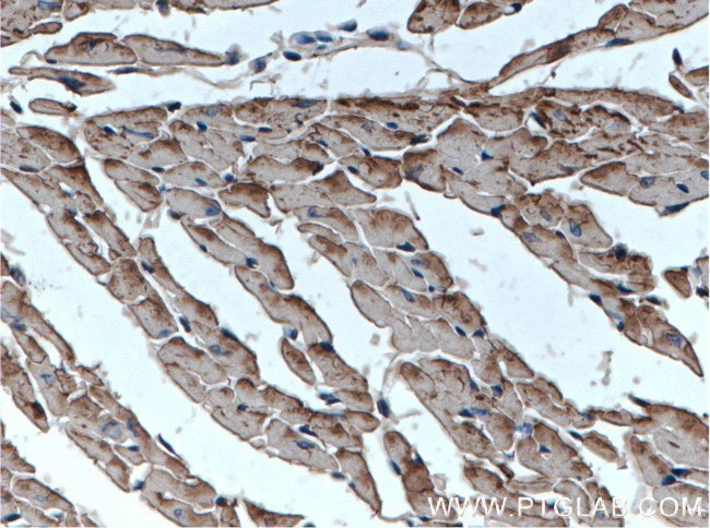 Cardiac Troponin T Antibody in Immunohistochemistry (Paraffin) (IHC (P))