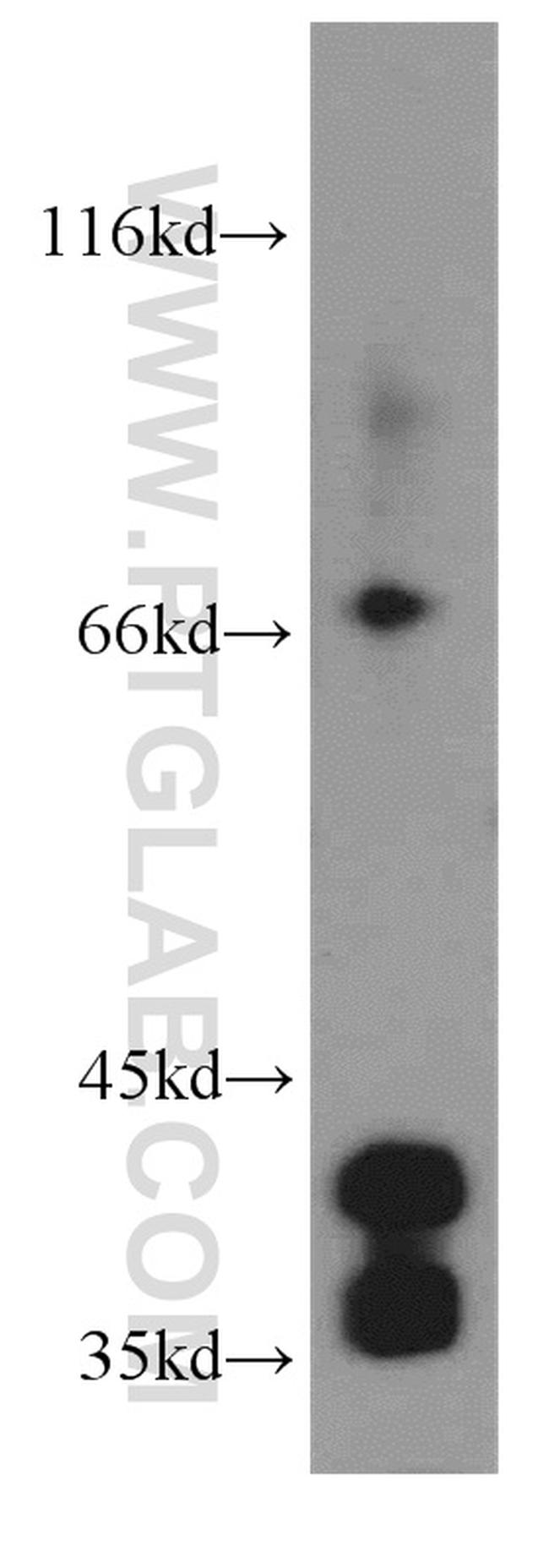 Cardiac Troponin T Antibody in Western Blot (WB)