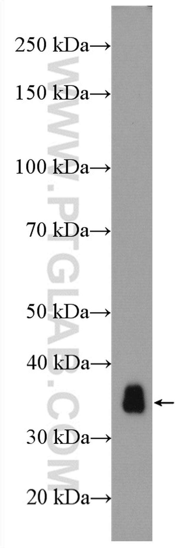 Cardiac Troponin T Antibody in Western Blot (WB)