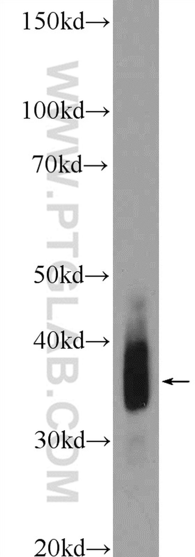 Cardiac Troponin T Antibody in Western Blot (WB)