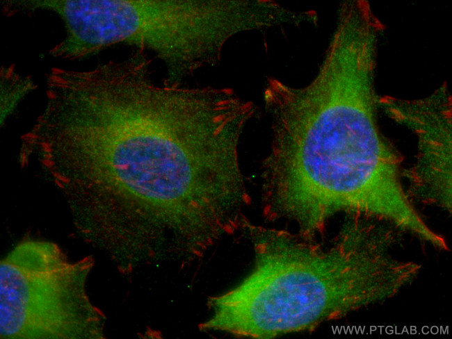 Beta galactosidase Antibody in Immunocytochemistry (ICC/IF)