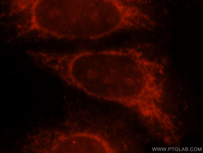 Beta galactosidase Antibody in Immunocytochemistry (ICC/IF)