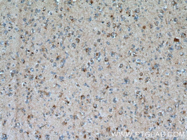 Beta galactosidase Antibody in Immunohistochemistry (Paraffin) (IHC (P))