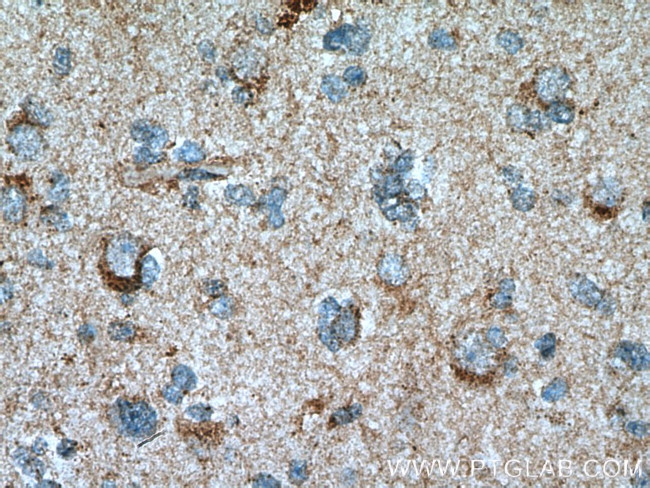 Beta galactosidase Antibody in Immunohistochemistry (Paraffin) (IHC (P))