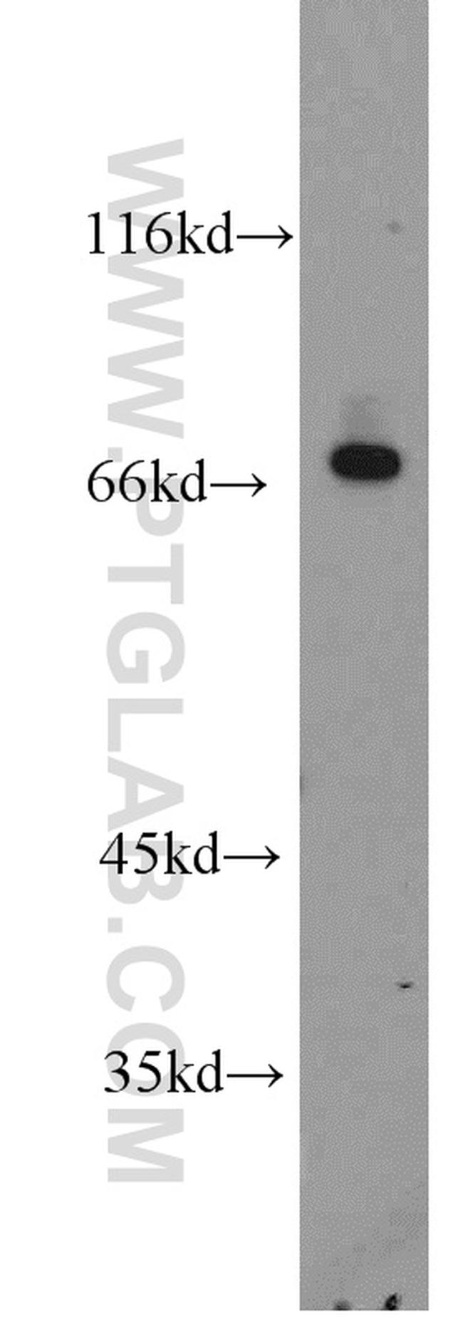 Beta galactosidase Antibody in Western Blot (WB)