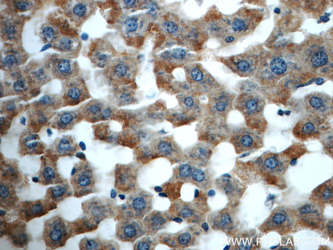 HACL1 Antibody in Immunohistochemistry (Paraffin) (IHC (P))