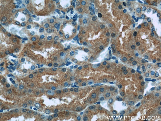 HACL1 Antibody in Immunohistochemistry (Paraffin) (IHC (P))