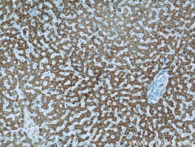 HACL1 Antibody in Immunohistochemistry (Paraffin) (IHC (P))