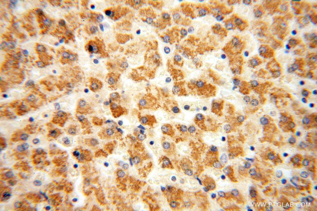 HACL1 Antibody in Immunohistochemistry (Paraffin) (IHC (P))