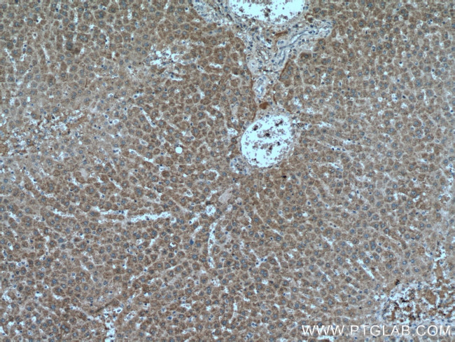 HACL1 Antibody in Immunohistochemistry (Paraffin) (IHC (P))