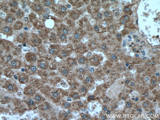 HACL1 Antibody in Immunohistochemistry (Paraffin) (IHC (P))