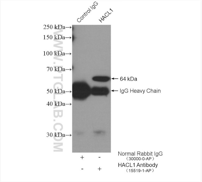 HACL1 Antibody in Immunoprecipitation (IP)