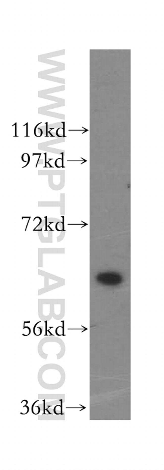 HACL1 Antibody in Western Blot (WB)