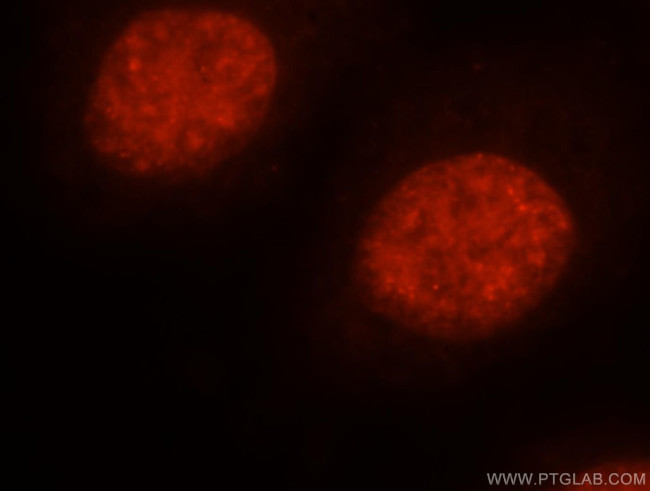 MSH2 Antibody in Immunocytochemistry (ICC/IF)