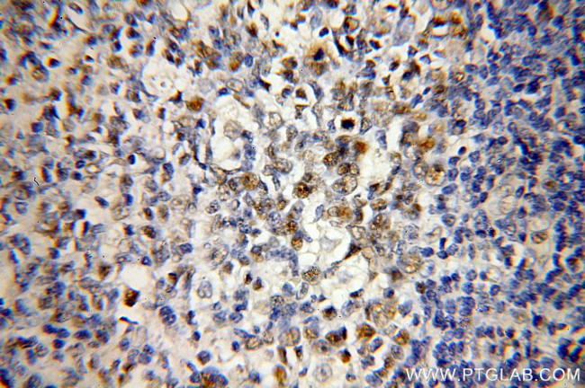 MSH2 Antibody in Immunohistochemistry (Paraffin) (IHC (P))