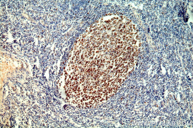 MSH2 Antibody in Immunohistochemistry (Paraffin) (IHC (P))