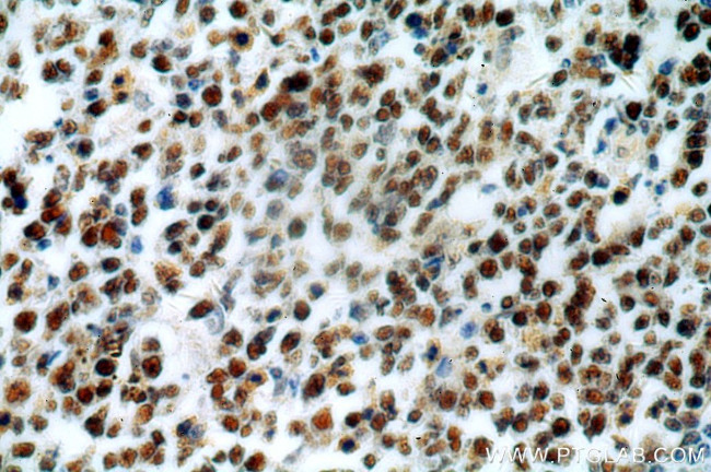 MSH2 Antibody in Immunohistochemistry (Paraffin) (IHC (P))