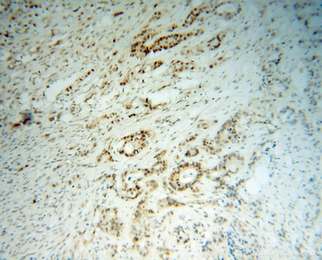 MSH2 Antibody in Immunohistochemistry (Paraffin) (IHC (P))