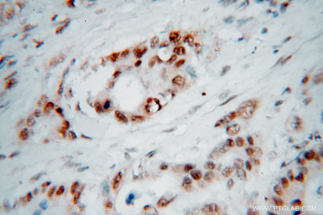 MSH2 Antibody in Immunohistochemistry (Paraffin) (IHC (P))