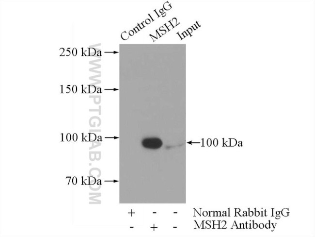 MSH2 Antibody in Immunoprecipitation (IP)