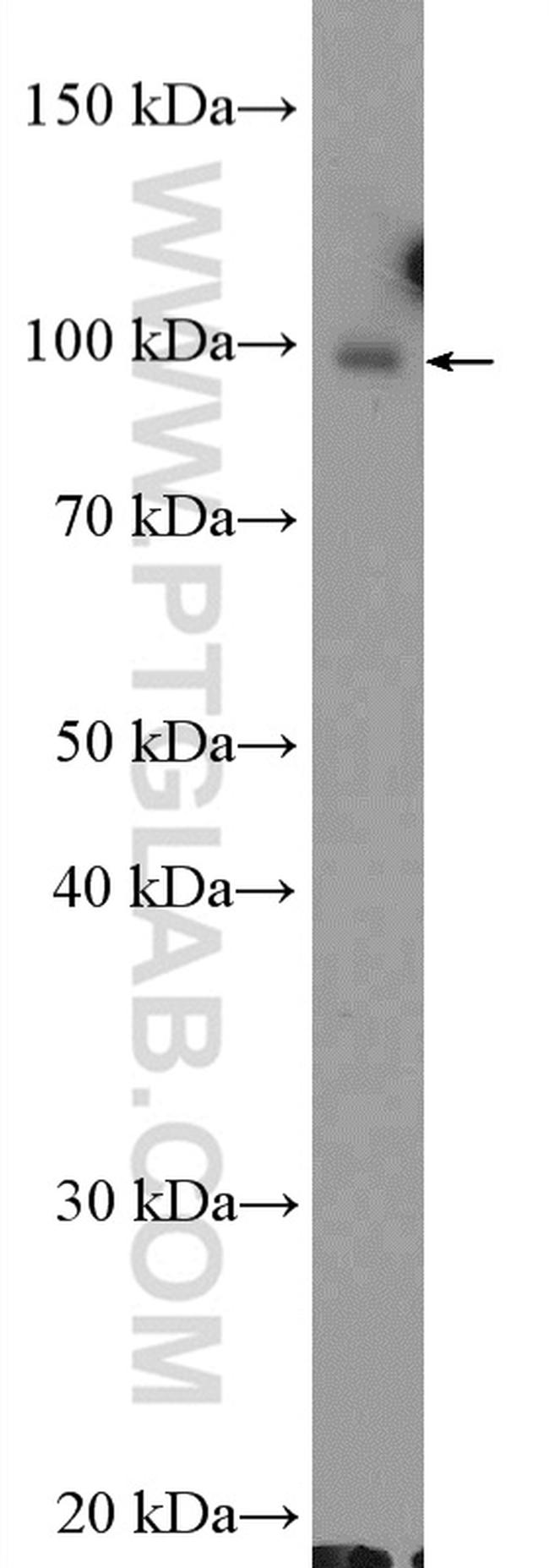 MSH2 Antibody in Western Blot (WB)