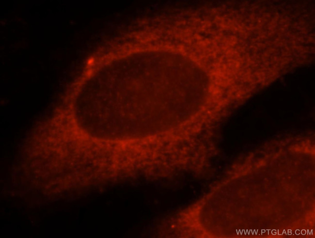 KCTD12 Antibody in Immunocytochemistry (ICC/IF)