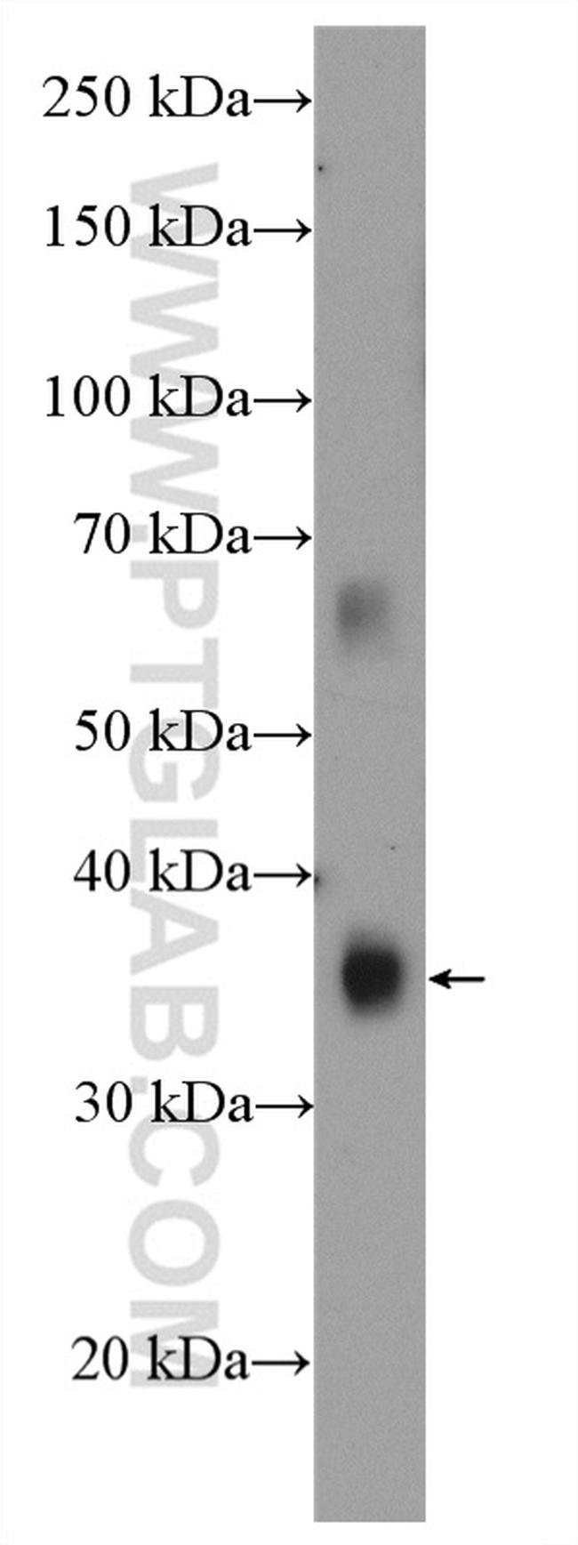 KCTD12 Antibody in Western Blot (WB)