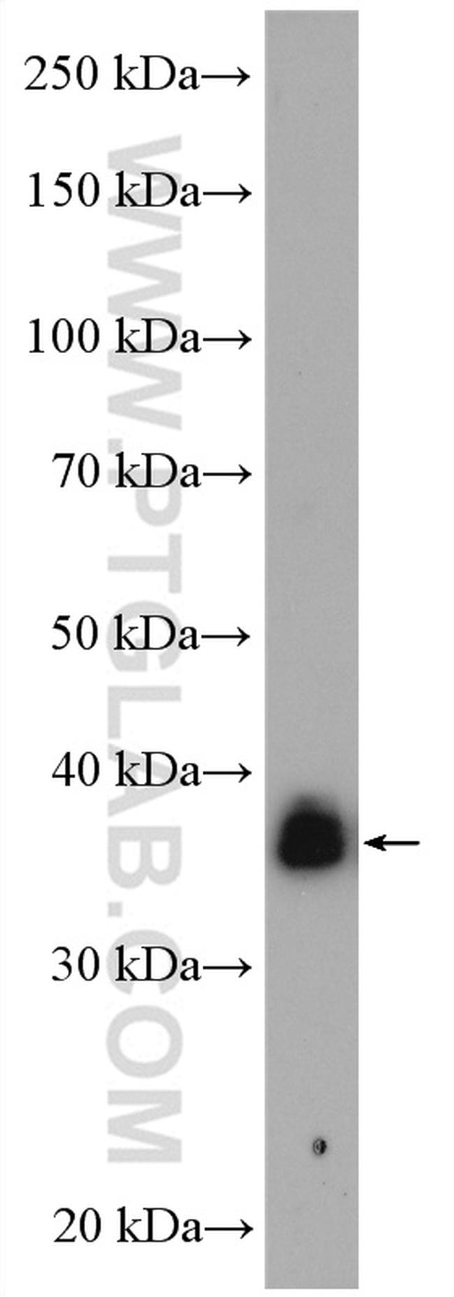 KCTD12 Antibody in Western Blot (WB)