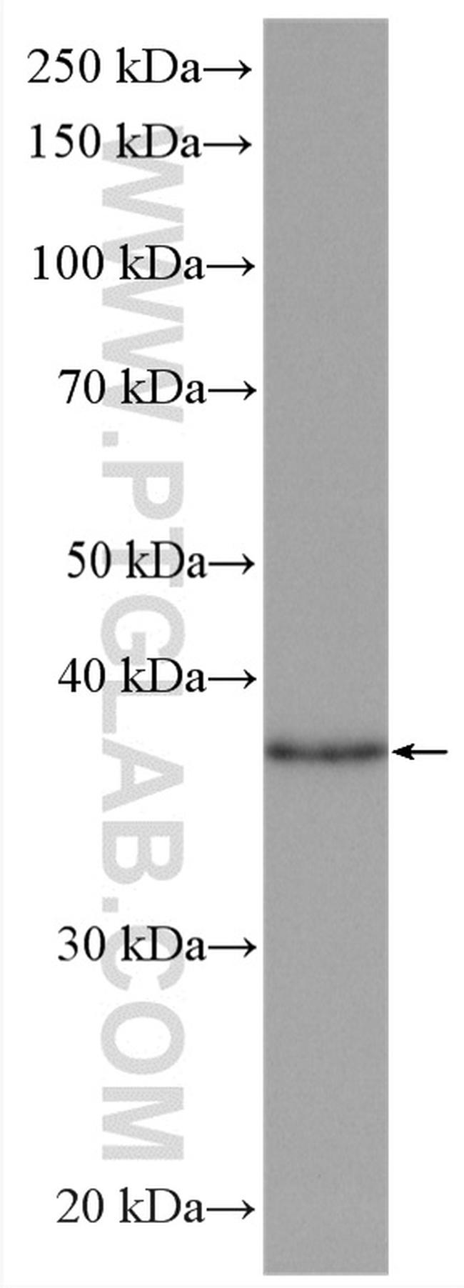 KCTD12 Antibody in Western Blot (WB)